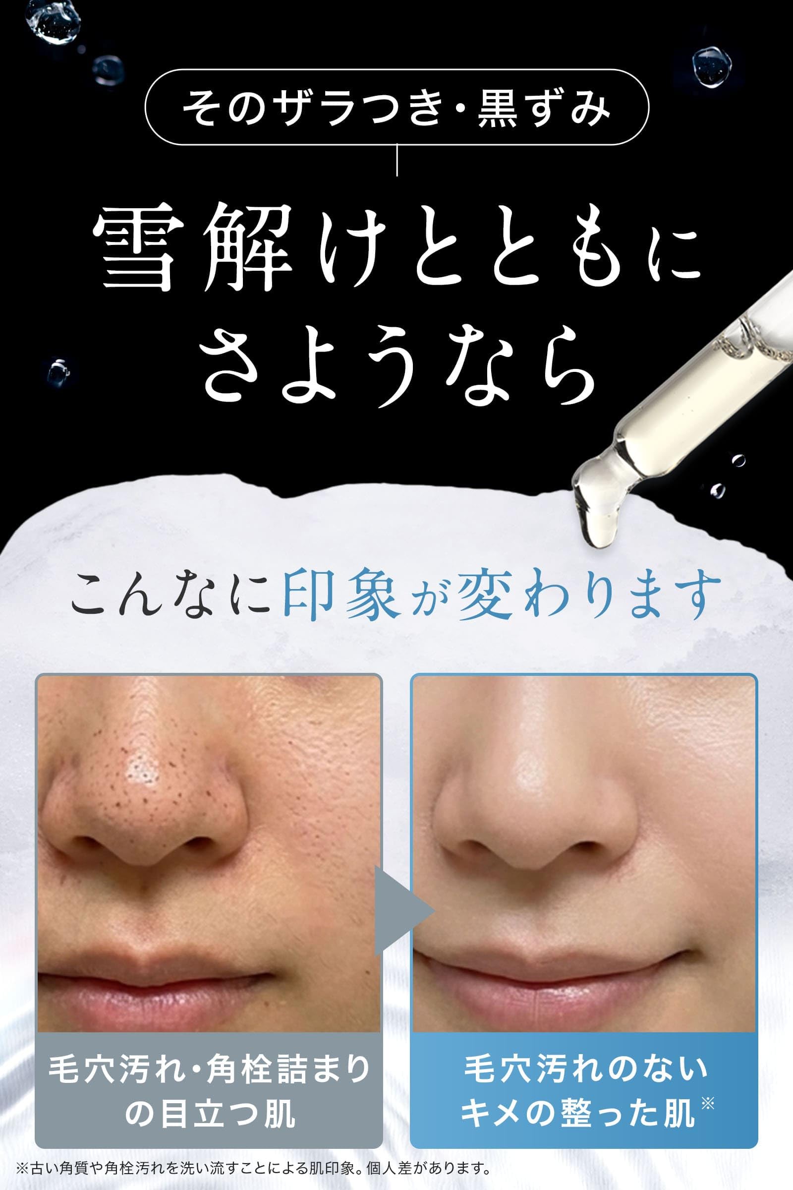 Amazon | idio 北海道雪どけスキンピール クレンジングオイル 角栓