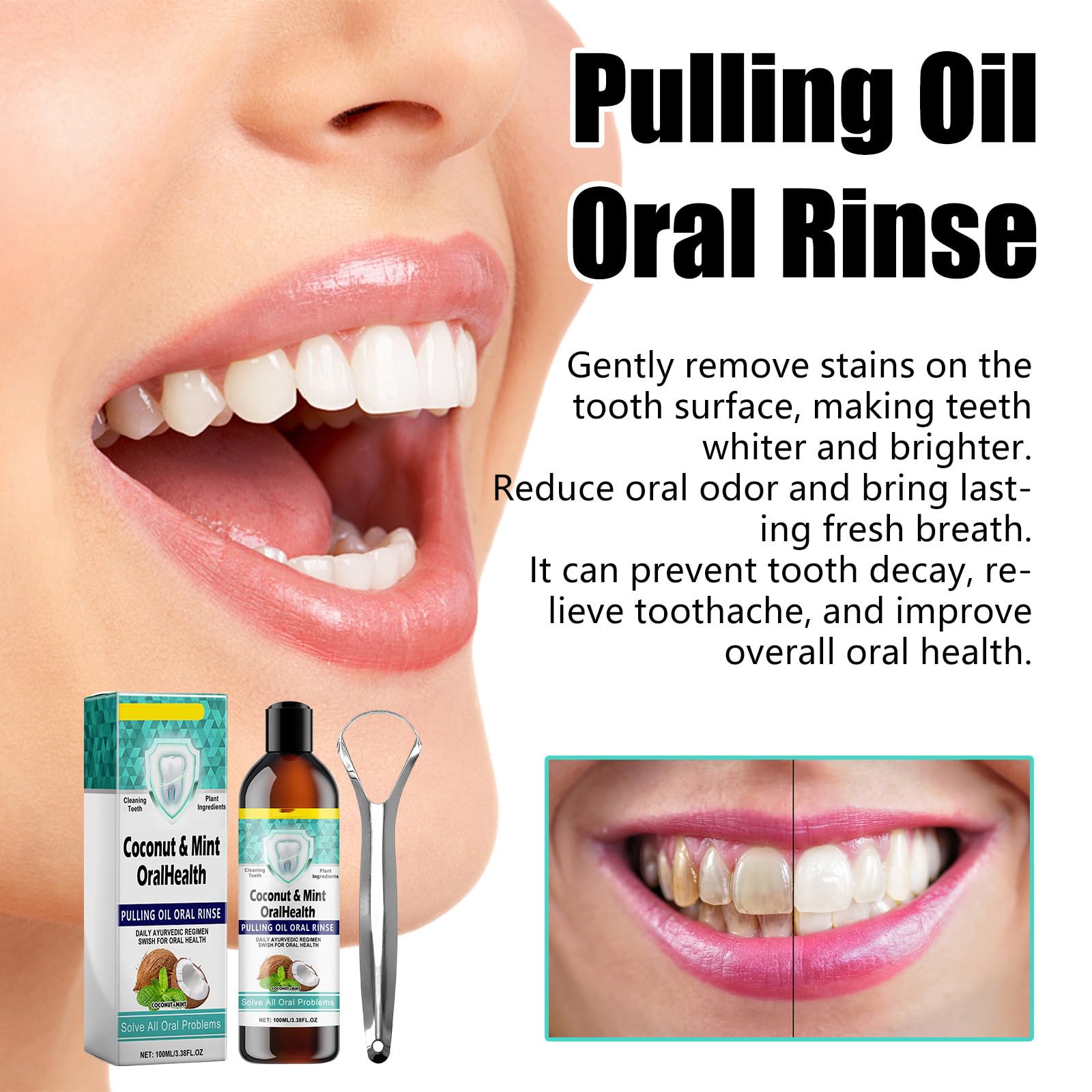 Enjuague bucal con aceite de coco - Enjuague bucal con aceite de coco para el cuidado bucal - Colutorio natural para combatir la placa y el mal aliento - con raspador de lengua para (8 botellas)