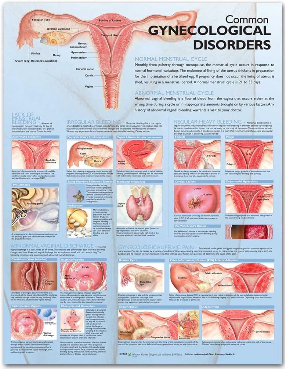 Common Gynecological Disorders Anatomical Chart