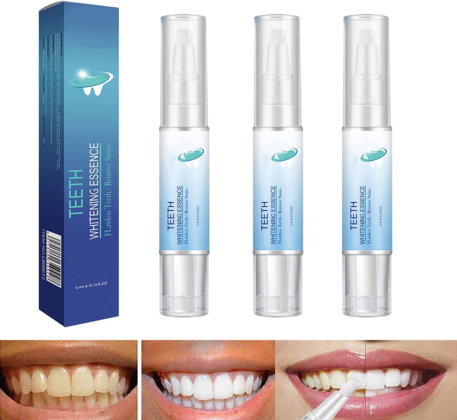 SYOSI Teeth Whitening Pen, 12ml Mint Gel, Natural, Fast Stain Removal, Adult Use