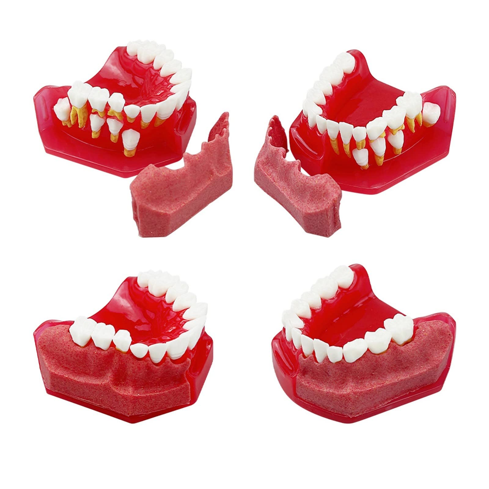 Milchzahnmodell für Kinder, 1: 1-Ersatzzahnmodell, Oralmodell, Milchzahn, alternatives Anzeigemodell, Zahnmodell