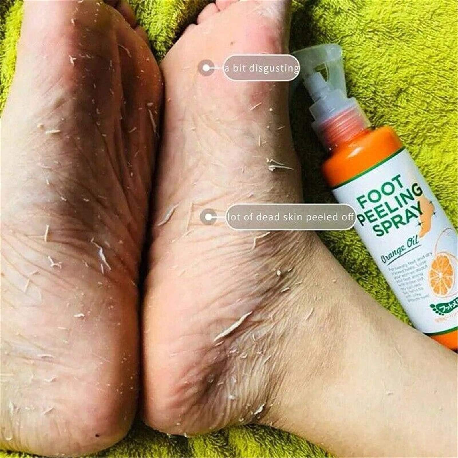 Spray peeling istantaneo per i piedi, maschera per i piedi per staccare la pelle morta, rimuovono la pelle morta in pochi secondi, peeling esfoliante e calli sui piedi