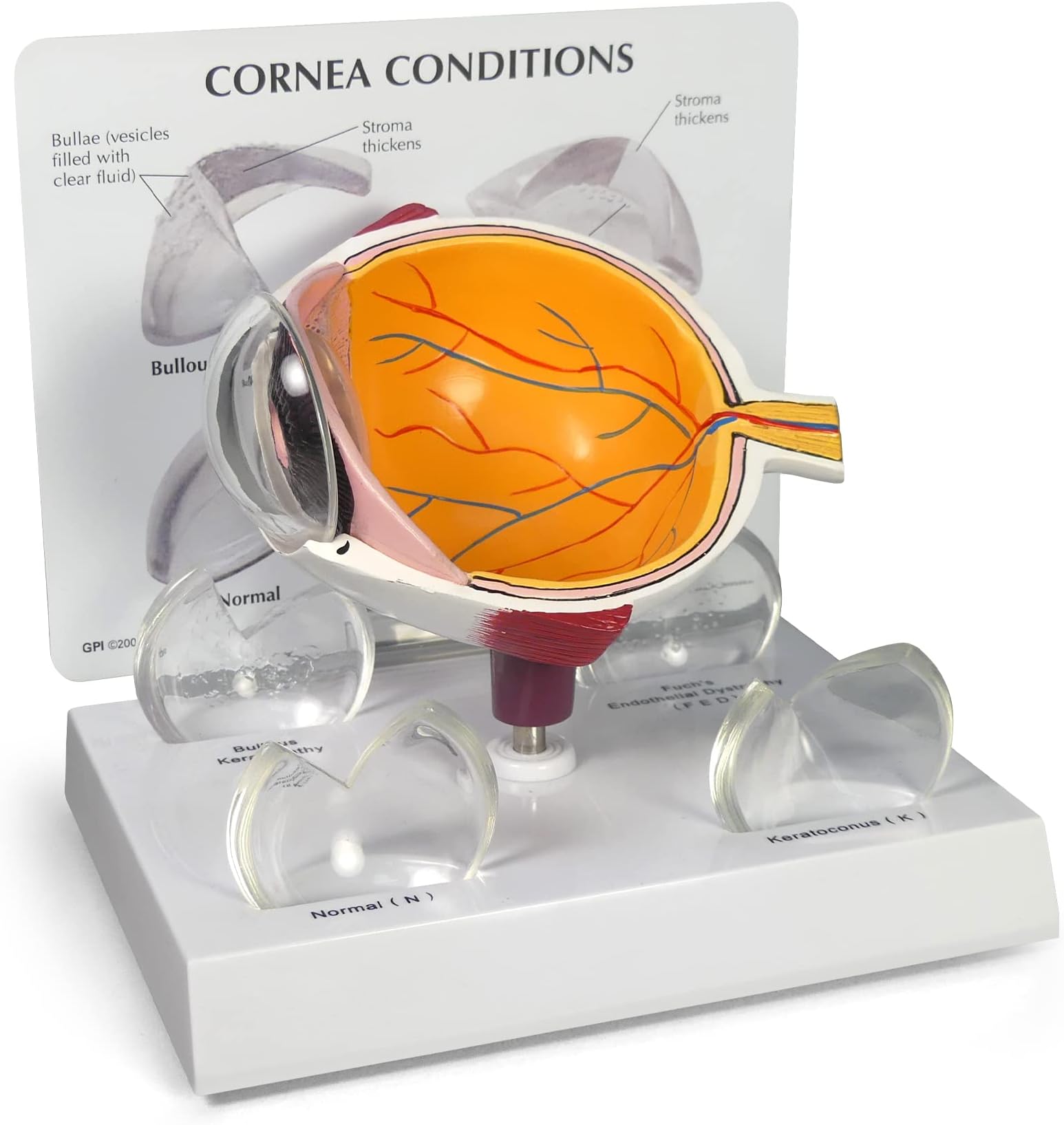 GPI Anatomicals - Cornea Eye Model, Replica for Human Anatomy and Physiology Education, Anatomy Model for Doctor's Offices and Classrooms, Medical Learning Resources