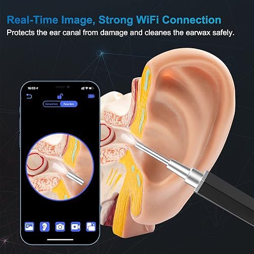 Miniatura 2 de Eliminación de cera de oído limpiador de oídos con cámara herramienta removedor de cera de oído kit de otoscopio de cámara de oído con luz cámara de