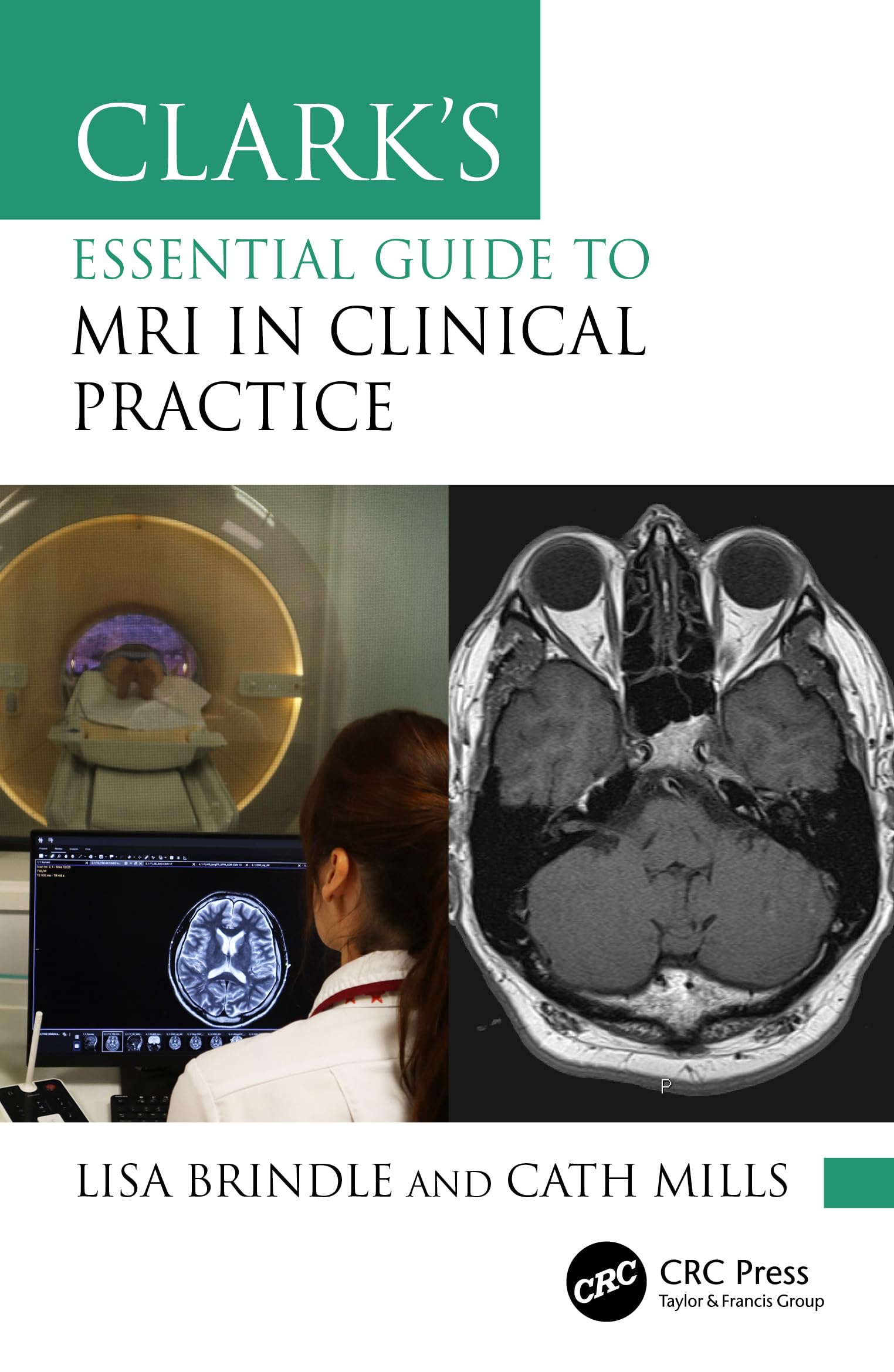 Clark's Essential Guide to MRI in Clinical Practice (Clark's Companion Essential Guides)