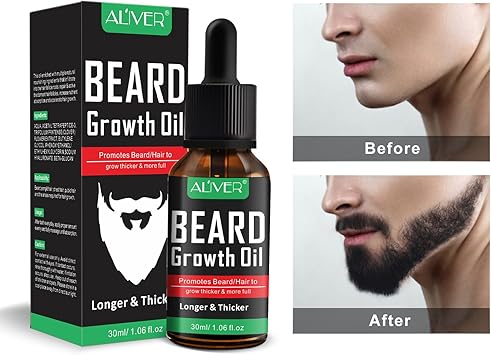 Beard Growth Oil Natural Organic Hair Growth Oil Beard Oil Enhancer Facial Nutrition Moustache Grow Beard Shaping Tool Beard Care Products Hair Loss Products 30ml Beard Growth Oil Amazon Ca Beauty Beard Growth Oil Natural Organic Hair Growth Oil Beard Oil Enhancer Facial Nutrition Moustache Grow Beard Shaping Tool Beard Care Products Hair Loss Products 30ml Beard Growth Oil Amazon Ca Beauty