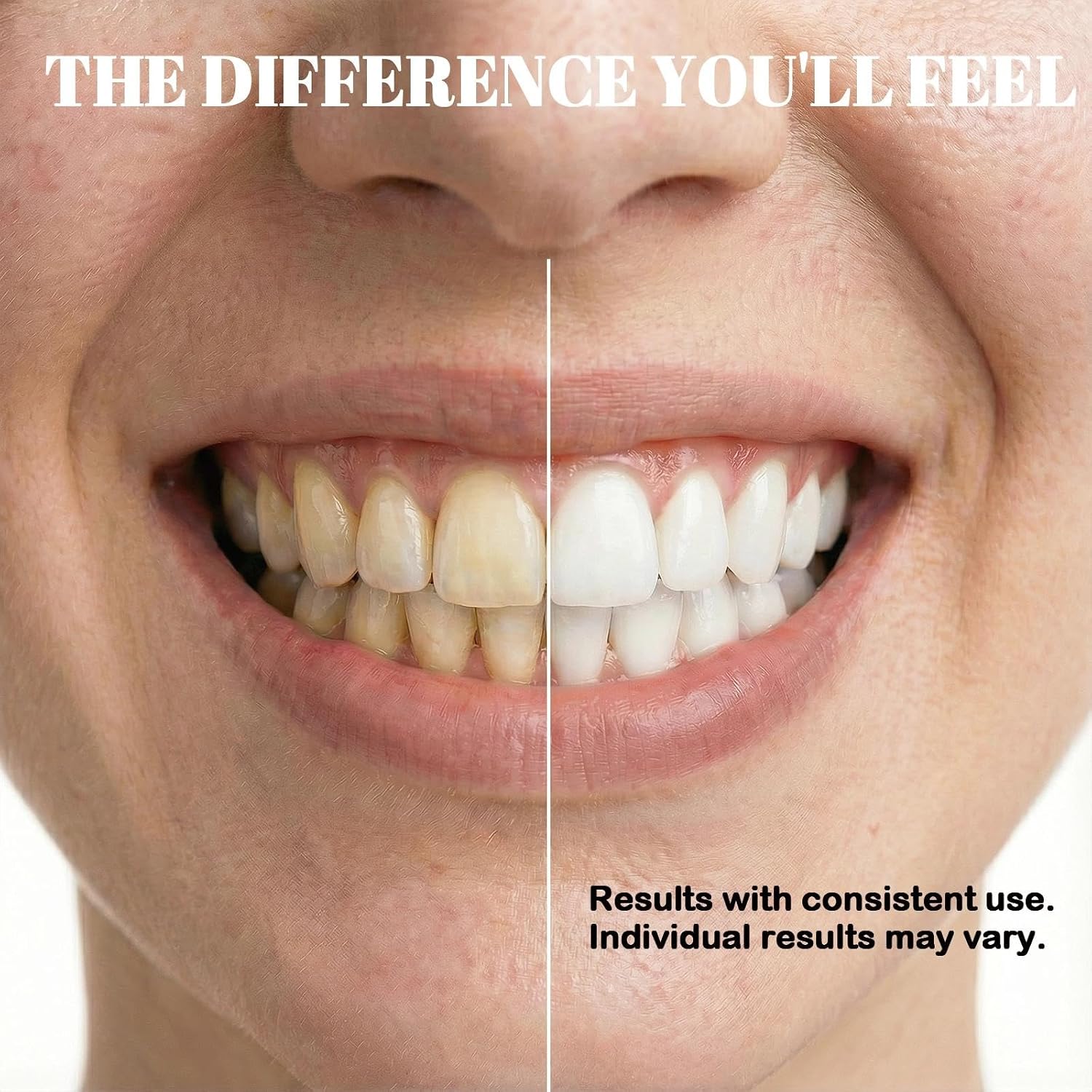Nano Hydroxyapatite Toothpaste 7.5% (n-HA) - Fluoride Free Enamel Repair & Sensitivity Relief. Gentle Whitening for Coffee Stains, Gum Health & Cavity Defence. Natural Mint, Family Safe - 4