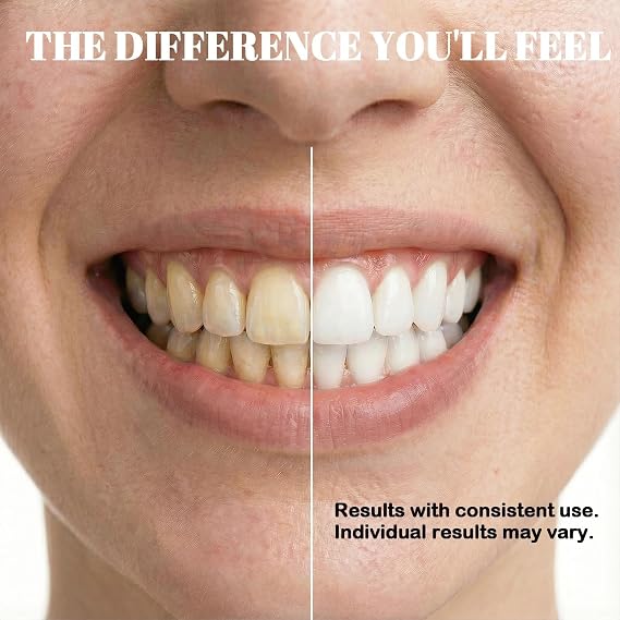 10% Nano Hydroxyapatite Toothpaste - High Concentration for Intensive Enamel Remineralisation. Instant Sensitivity Relief, Deep Whitening & Plaque Control. Fluoride Free Formula