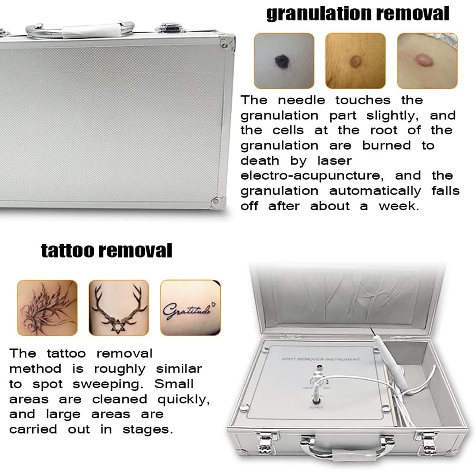 Stylo Électronique Pour Enlever Les Tatouages ​​et Les Grains De Beauté, Stylo Pour Enlever Les Acrochordons Avec 10 Niveaux De Puissance Réglables,Outil De Soin Du Visage,Pour Les Taches Brunes