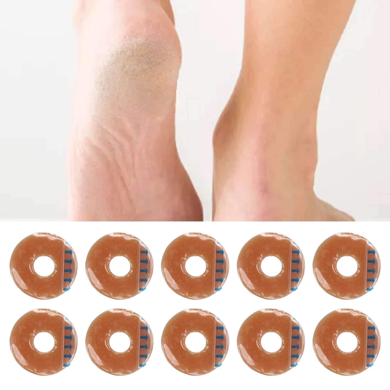10 Stück Ostomie-Barriere-Ringe, Ostomie-Tasche, Hautbarriere, Silikon, formbar, auslaufsicher, Hautschutz, Kolostomie-Tasche, Hautbarriere