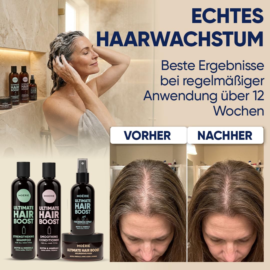 MOERIE Shampoo Set - gegen Haarausfall, Conditioner, Haarwachstum Serum & Haarmaske - natürlich Haarwachstum beschleunigen - Veganes Haarwuchsmittel Frauen & Männer - 77 Mineralien (4er-Set)