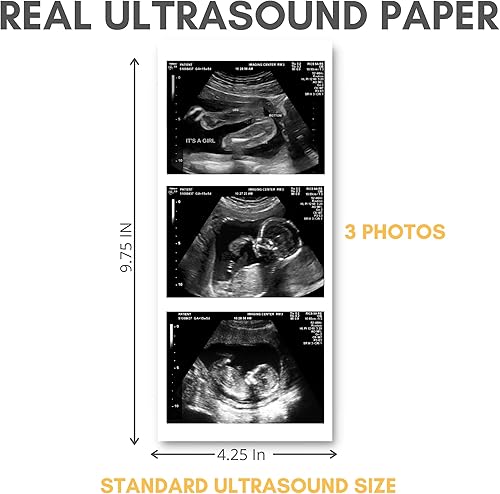 Miniatura 8 de Pranknant Imágenes de broma de ultrasonido falso  Tira 2D de 3 fotos  Sonograma de embarazo  Ultrasonido de embarazo de broma (gemelos)