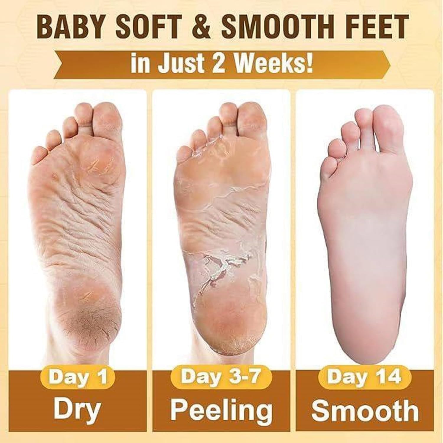 Netora Foot Peel Mask for Women & Men | Peeling & Exfoliating Foot Mask for Dry Cracked Feet, Removes Dead Skin & Calluses, Hydrates & Smooths Cracked Heels (Pack of 1) 1