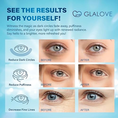 Miniatura 3 de Parches debajo de los ojos para ojos hinchados 60 almohadillas de gel de ojos de colágeno de retinol - Máscara de tratamiento de la piel para