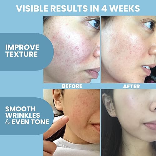 Miniatura 3 de Suero de péptido de colágeno para la cara, tratamiento facial antienvejecimiento con péptidos y ácido hialurónico, fórmula suave para pieles