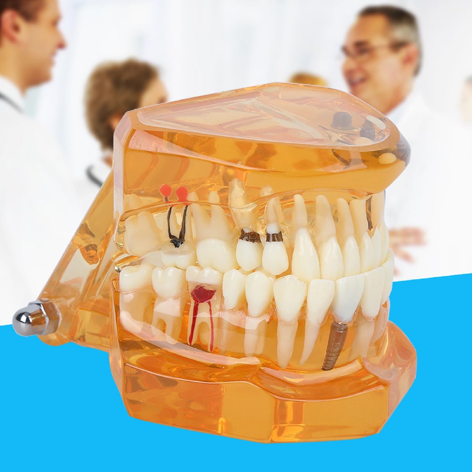 Modelo de Estudio de Dientes Dentales Extraíbles para Enseñanza Demostración Sobredentadura Maxilar Clínica Laboratorio Dentista