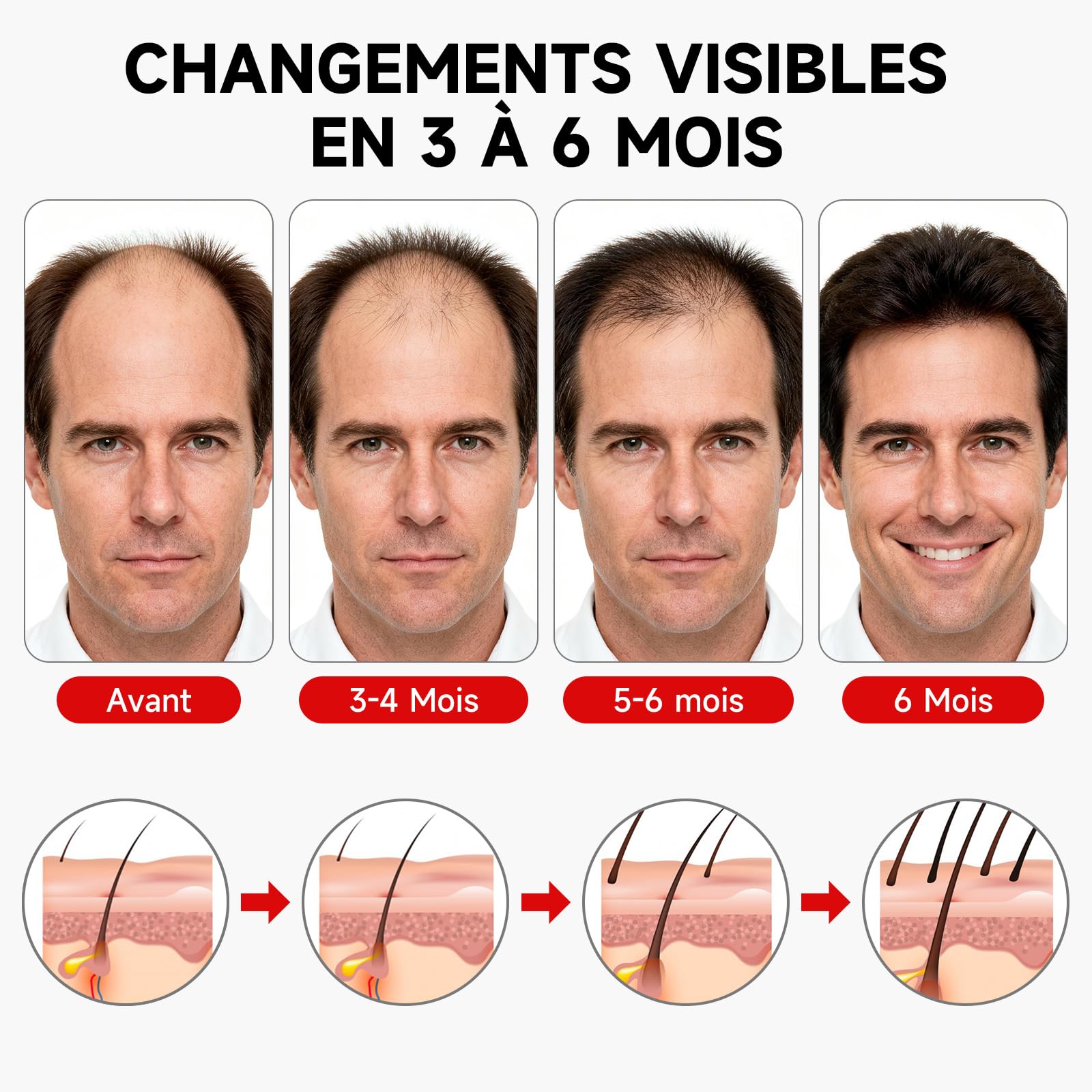 Casque LED Cheveux,Casque Pousse Cheveux,7 Modes Casque De Croissance De Cheveux 660nm+850nm, Sans fil Casque Anti Calvitie,Accélérer La Croissance Des Cheveux pour Femme Homme