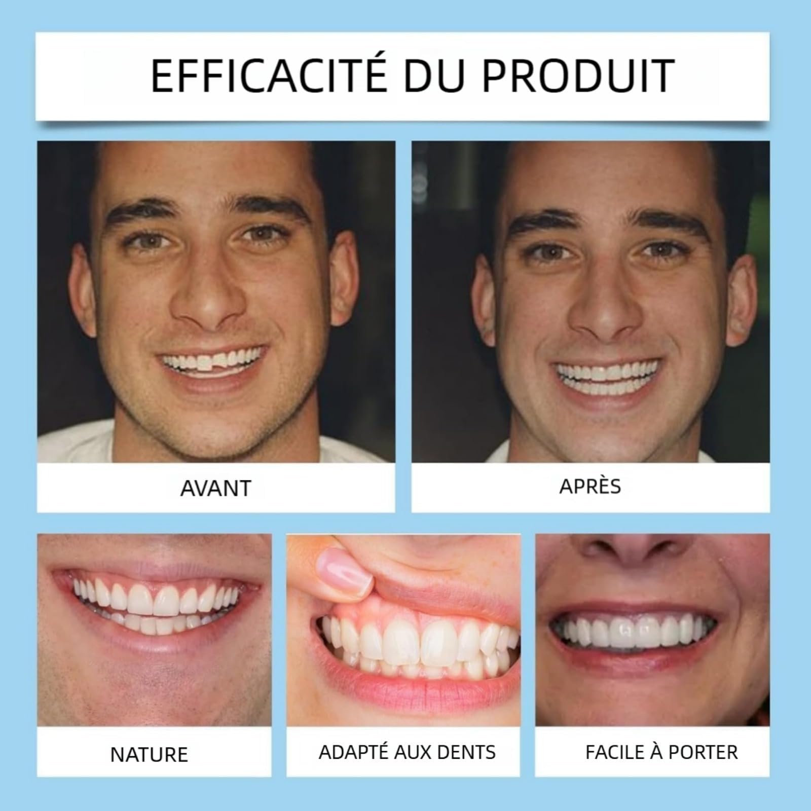 Protesi Dentale in Silicone per Uomini e Donne, Apparecchio Dentale | Protesi dentale in silicone regolabile, comfort ottimale, aspetto naturale per un sorriso perfetto immediato