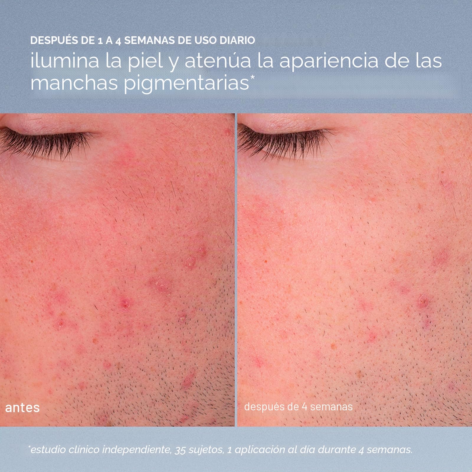 Dermalogica Daily Microfoliant, Exfoliante Facial en Polvo con AHA y Salvado de Arroz, Iluminador y Suavizante para Uso DIario