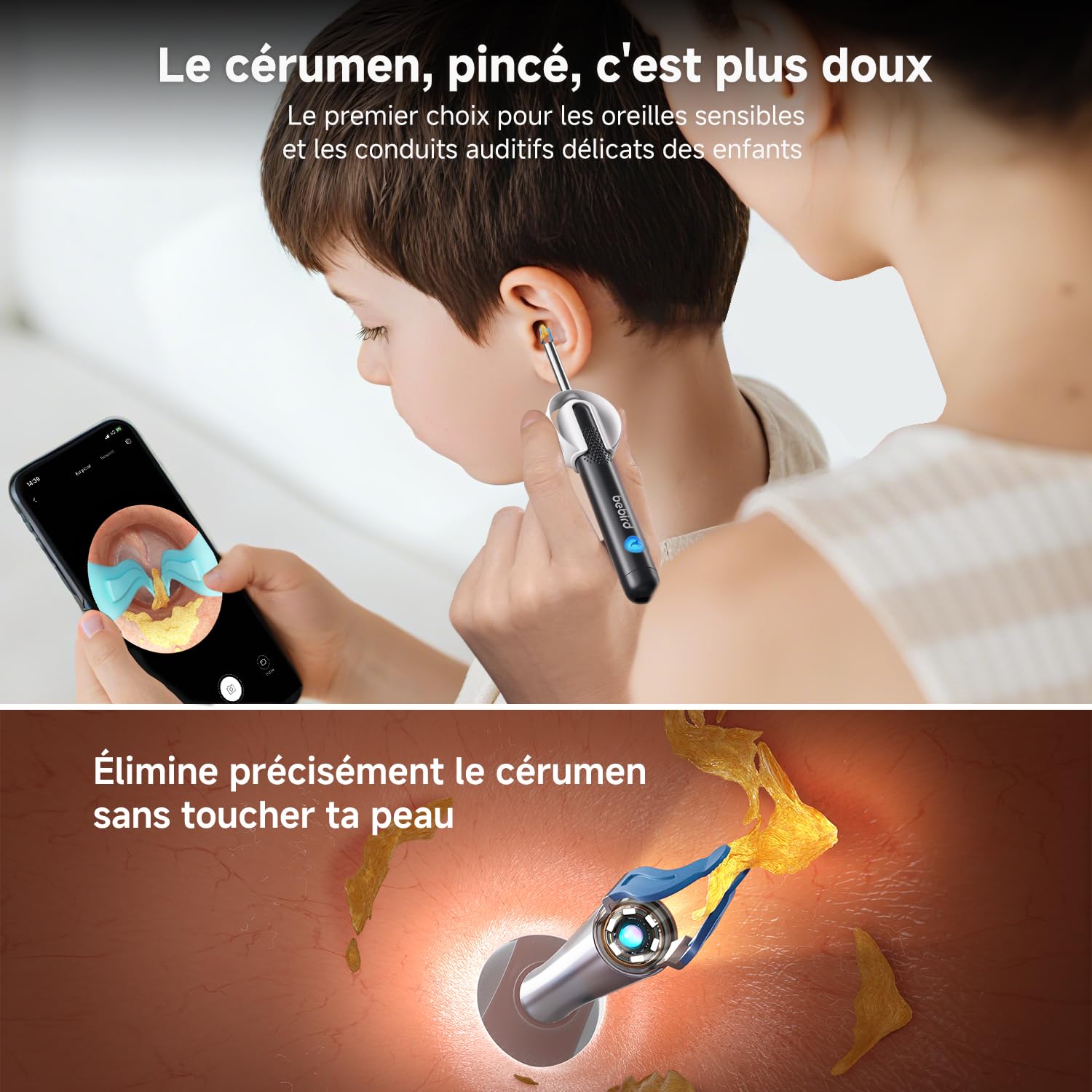 Otoscope Cure Oreille Nettoyage Camera Lumière Kit Élimination Cérumen Domestique