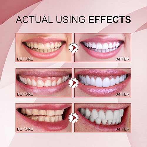 Miniatura 3 de Spray de aliento fresco, ambientador oral con sabor a frutas, compacto, portátil, refrescante, fresco, aliento fresco, cuidado de olores orales (5