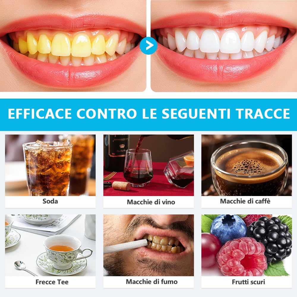 Kit Sbiancante Denti Professionale con Lampada 16 LED Blu,Quattro Penne Gel Sbiancante,Elimina le Macchie in 16 Minuti,con Applicazione Semplice e Veloce,Sicuro per lo Smalto