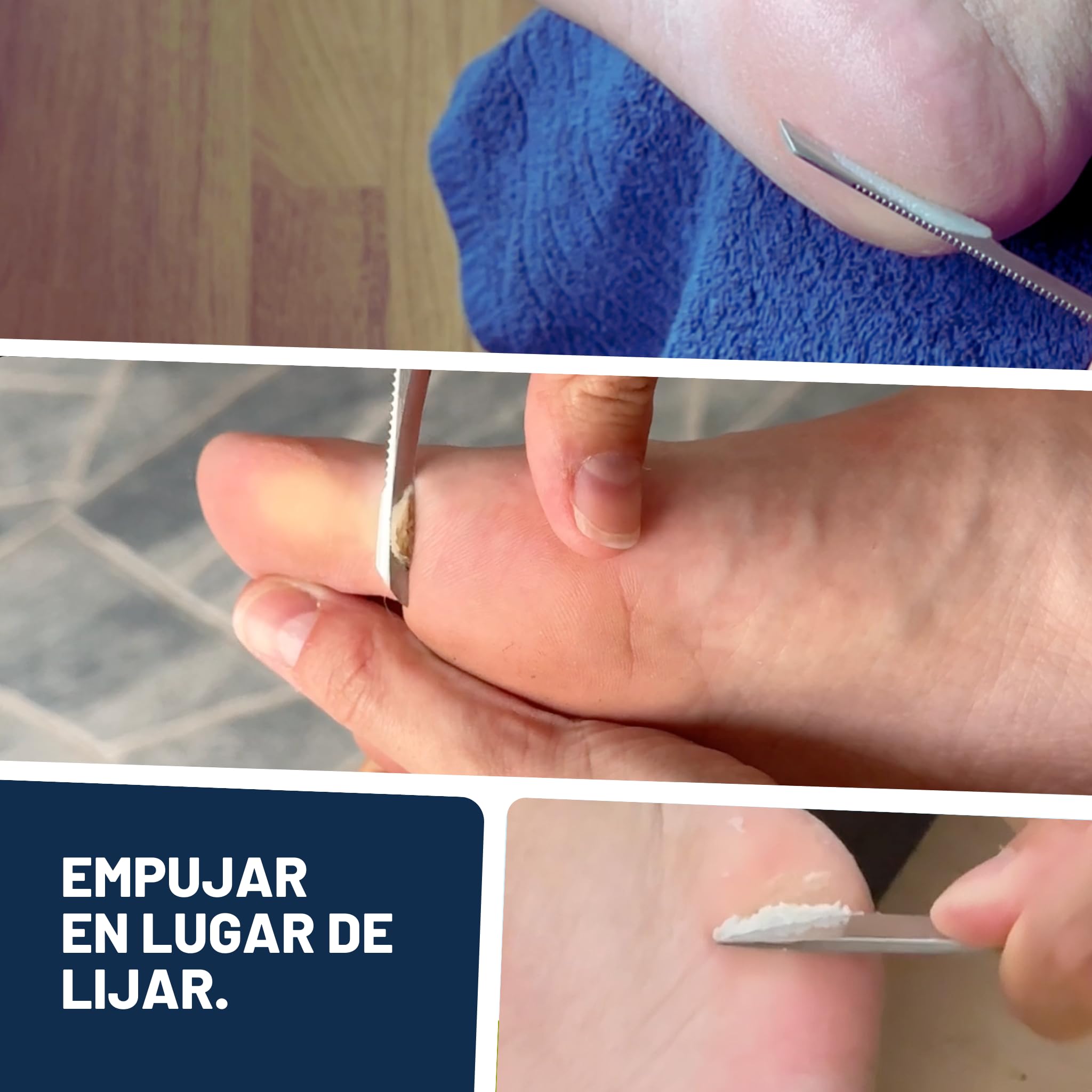 Mr. Fuss Removedor de Callos Solution No. 4 Advanced Pack Steel Quitar las Durezas Sin Raspar ni Frotar Paquete de Sistema de 4 Partes para la Eliminación de Callosidad y Cutícula