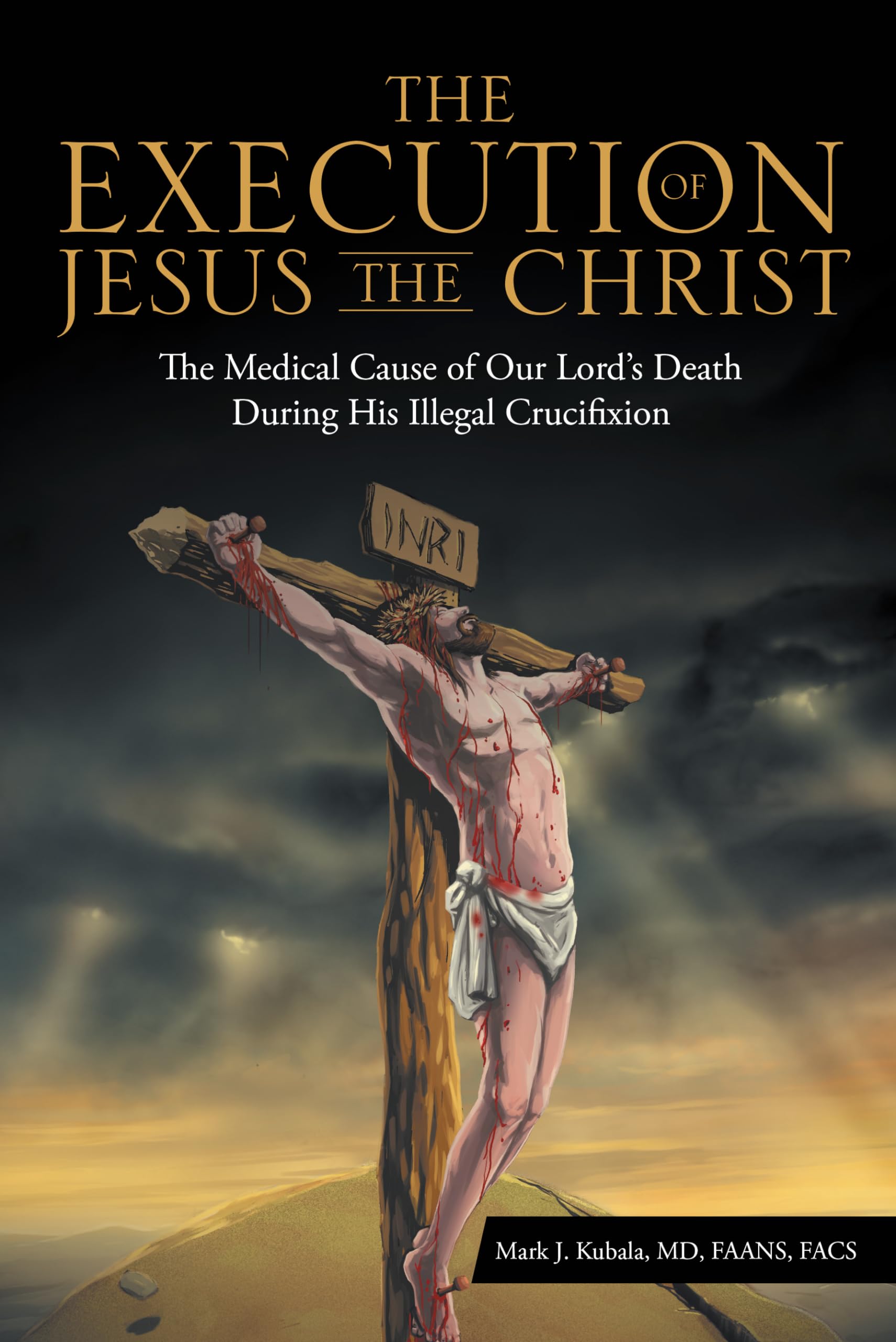 The Execution of Jesus the Christ: The Medical Cause of Our Lord’s Death During His Illegal Crucifixion