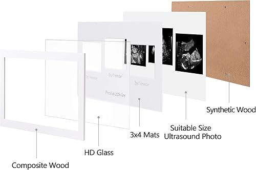 Miniatura 2 de eletecpro Marco de fotos de ultrasonido, para pantalla de fotos de ecografía de 3 x 4, marcos de fotos de sonograma para anuncio de embarazo,