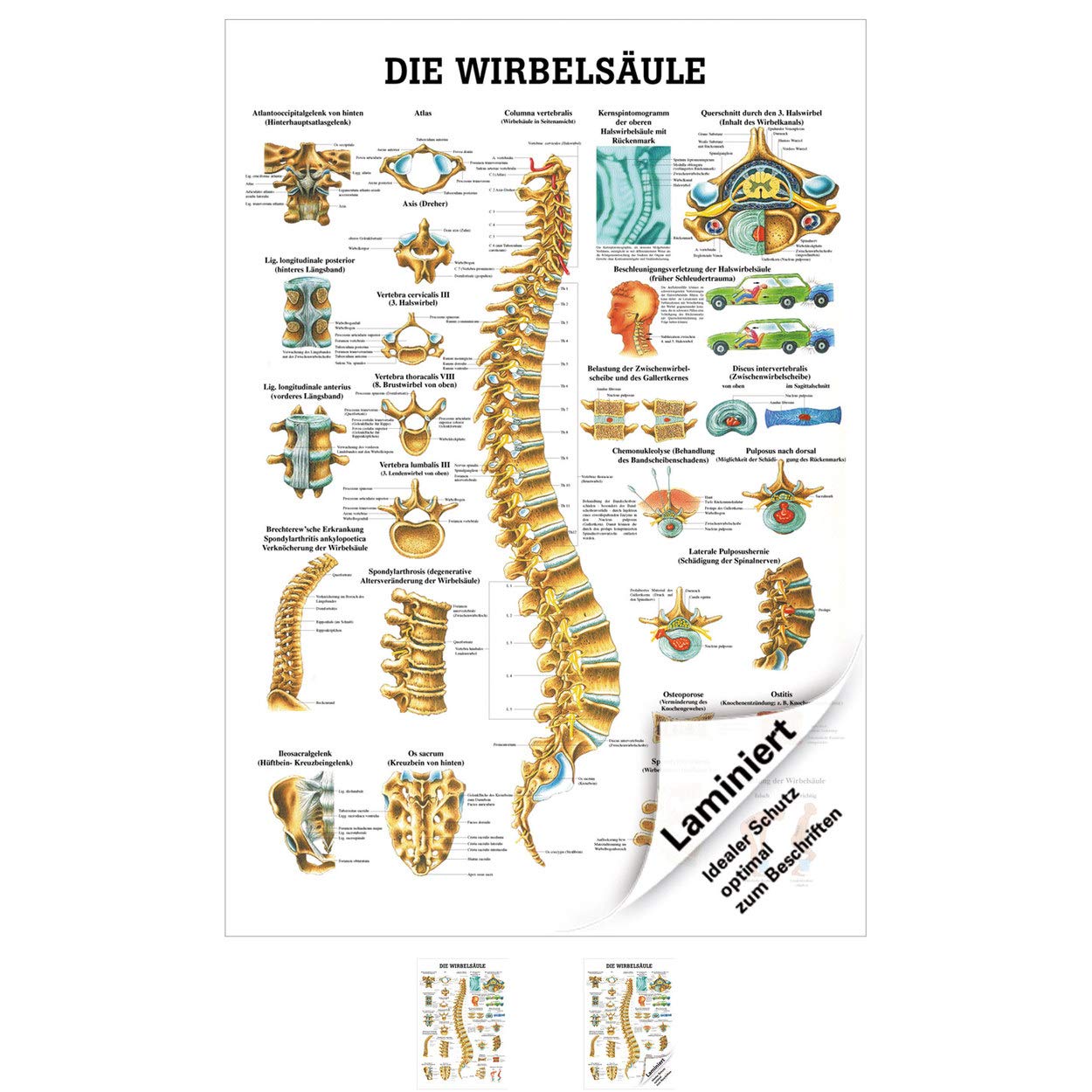 Sport-Tec Die Wirbelsäule Lehrtafel Anatomie 100x70 cm medizinische Lehrmittel