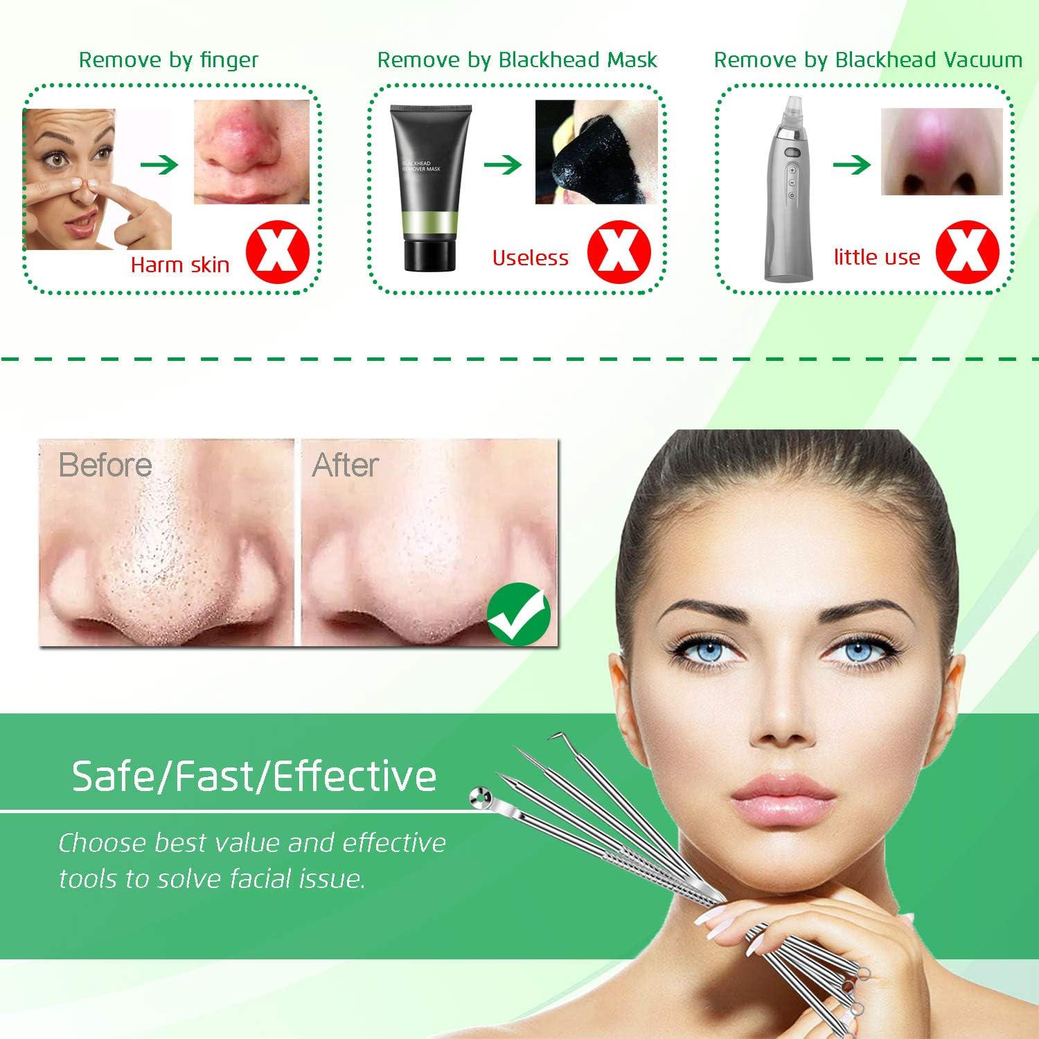 5PCS Blackhead Remover, Pimple Removal Tools, Blemish Whitehead Popping Removal, Whiteheads Spot Removing Zit Tool, Curved Blackhead Tweezers Kit, Treatment for for Risk Free Nose Face Skin : Beauty & Personal Care