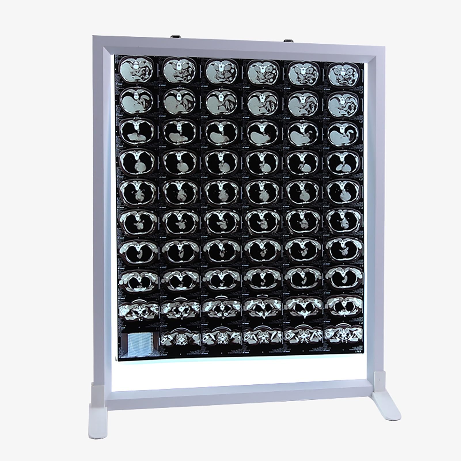 Lampada per Visione di Raggi X Pannello Luminoso per Pellicole Radiografiche 41x51cm Regolabile Medico Odontoiatrico