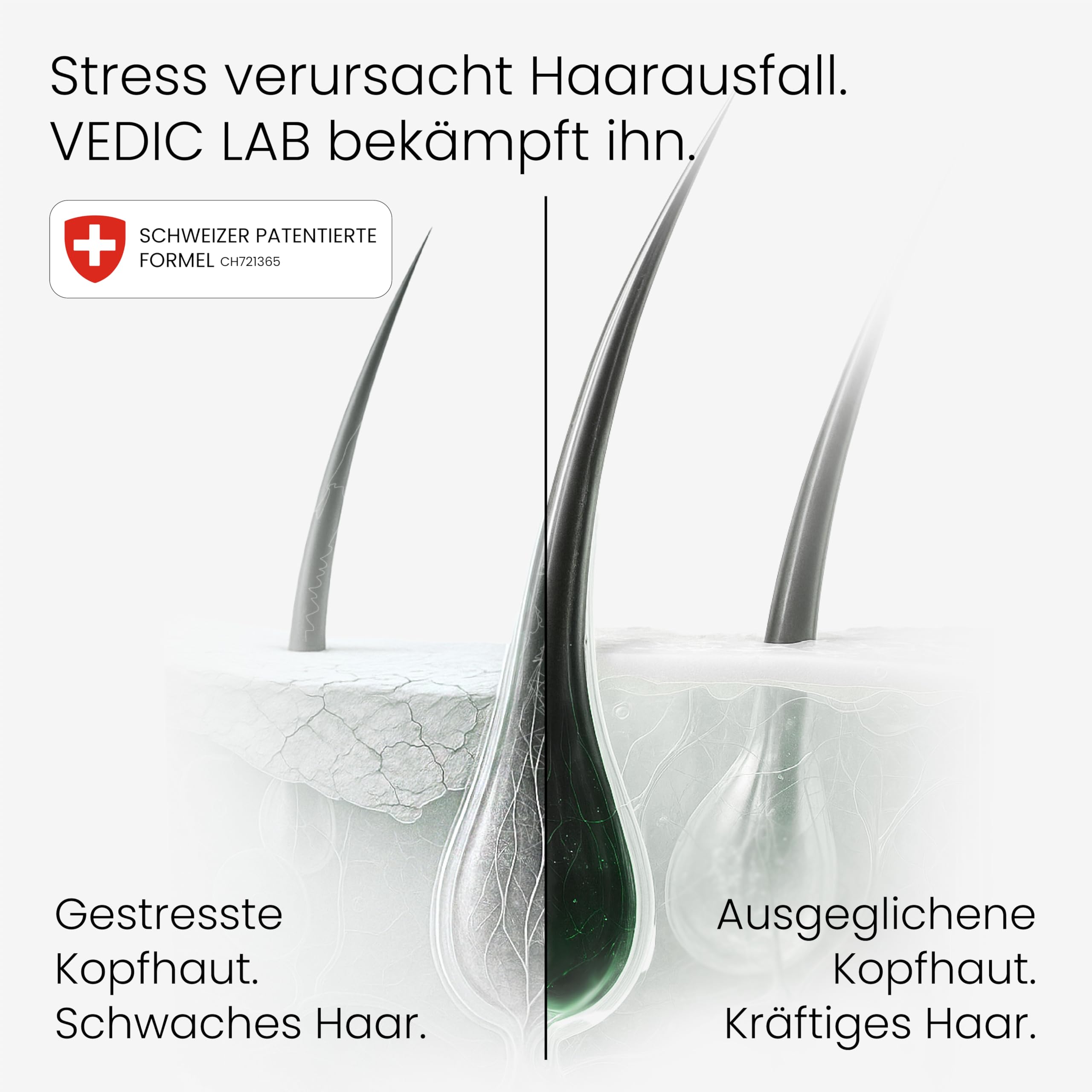 Nacht-Kopfhaut-Elixier | Anti-Haarausfall-Serum für Frauen | Effektive Haarwuchsbehandlung mit ayurvedischen Kräutern und Schweizer Biotech | 0% Minoxidil, 0% Aggressivität (100 ml)