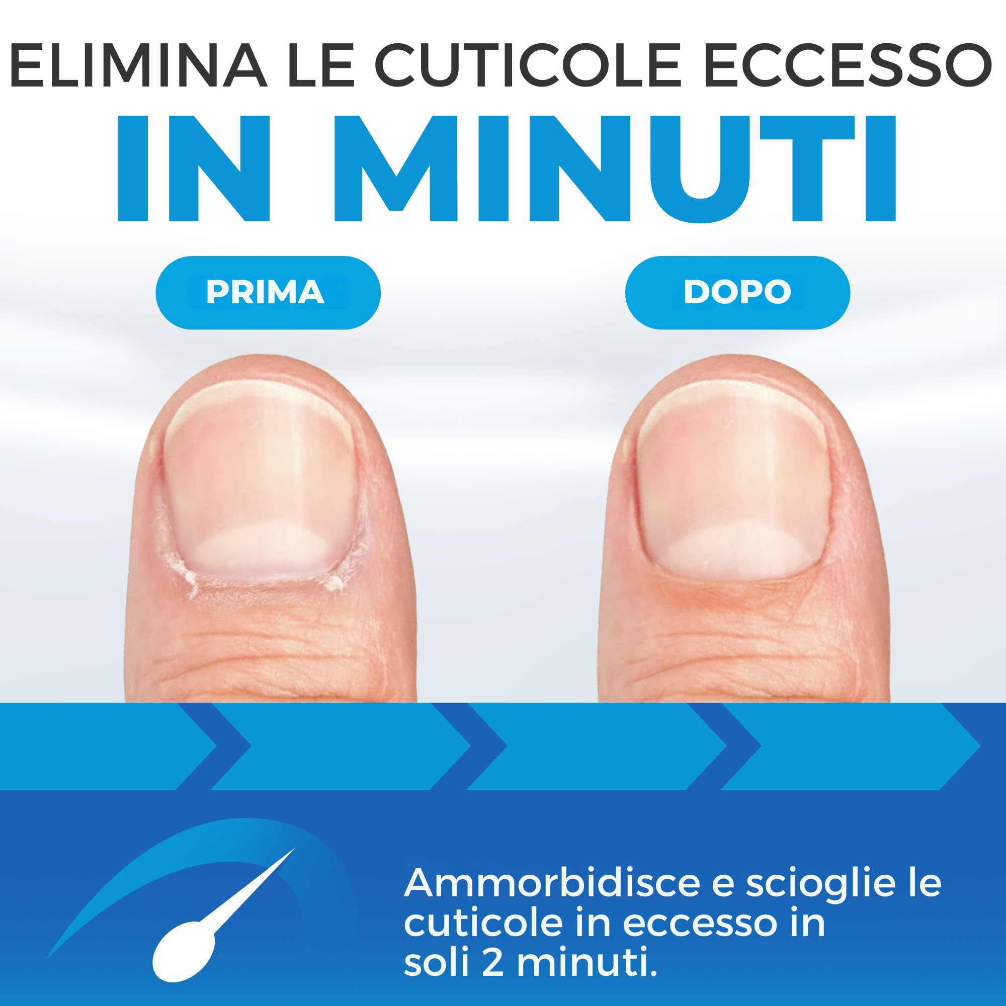 Imperial Feet Rimuovi Cuticole Liquido-150ml Formula Professionale | Rimozione Istantanea della Cuticola con Glicerina e Urea-Detergente per Unghie che Ammorbidisce e Scioglie le Cuticole in Eccesso