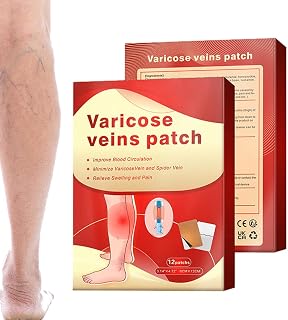 veia, pasta desvanecimento veias varicosas, Tratamento para varizes ajuda a reduzir a aparência varizes e vasinhos, restaura a aparência