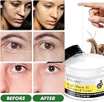 Snail Mucin 92% Advance Hydratant 3,52oz/100g, Hydrating visage crème pour sec & Peau sensible, tous types de peau