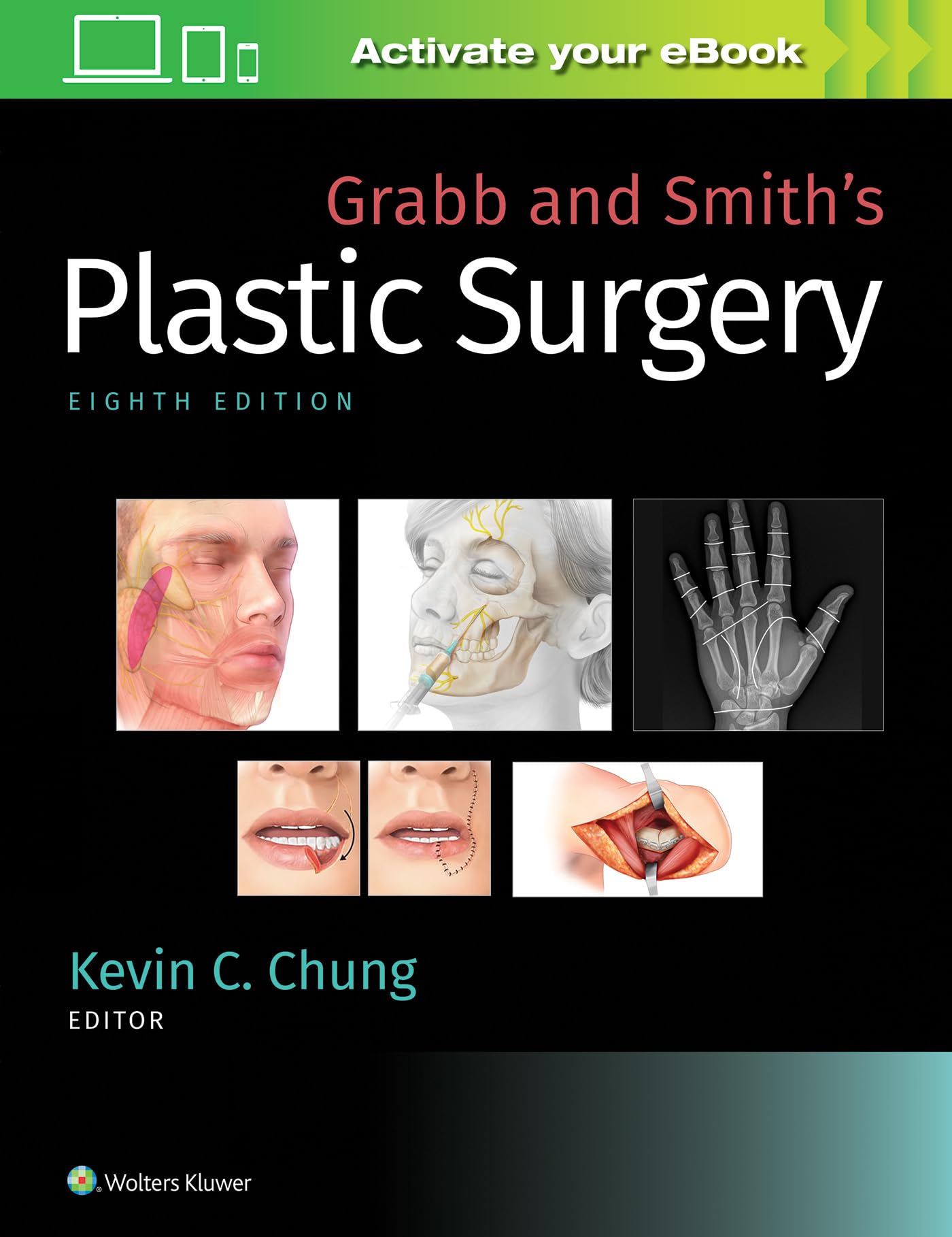 Grabb and Smith's Plastic Surgery: Chung MD MS, Kevin C