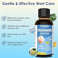 Vista 6 de Eliminador de verrugas con 17% de ácido salicílico, removedor de marcas cutáneas de acción rápida, tratamiento líquido para verrugas comunes