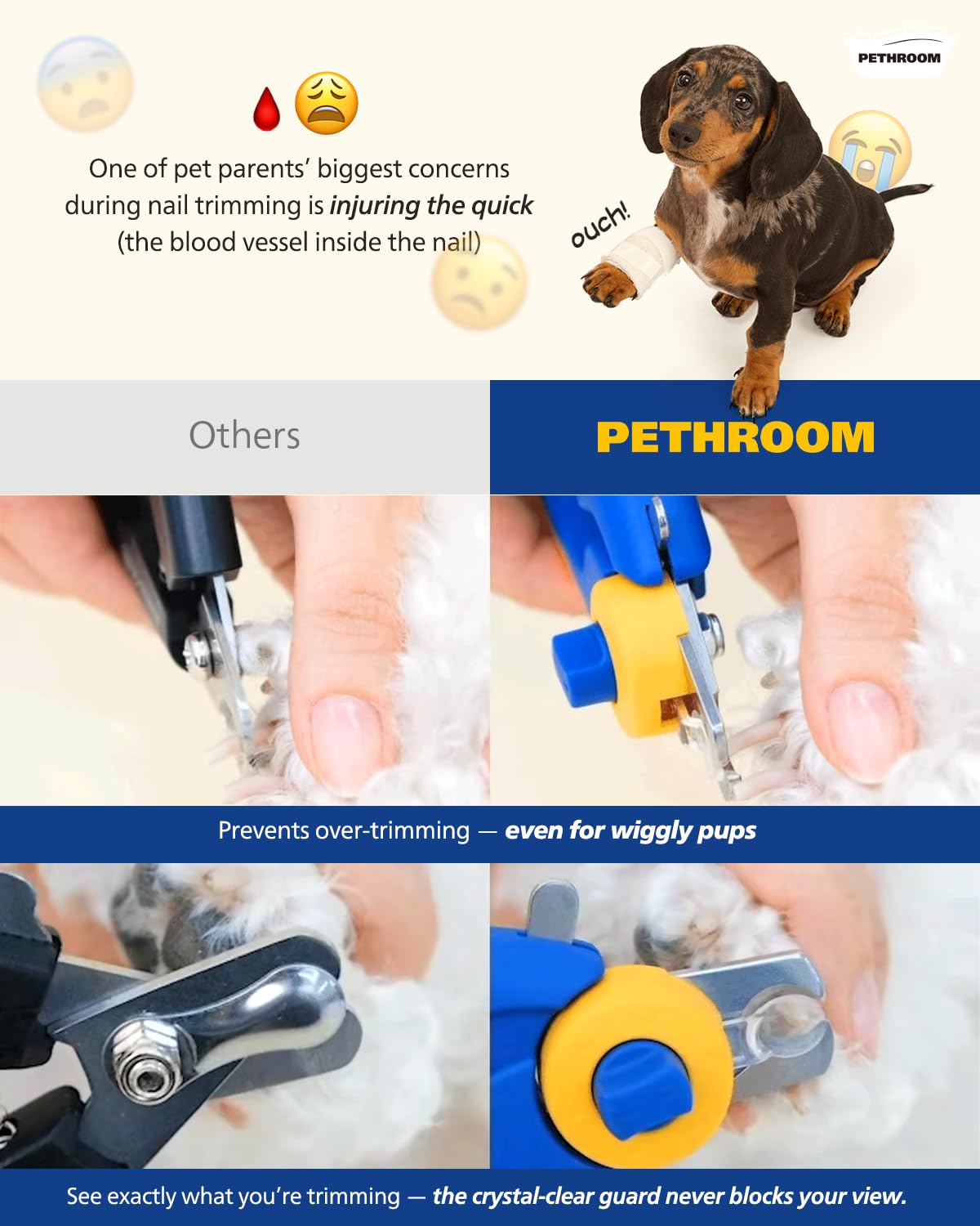 PETHROOM Cortaúñas para perros con lima de uñas, corte profesional rápido y fácil, guía de protección transparente para el aseo de mascotas, sin sobrecorte