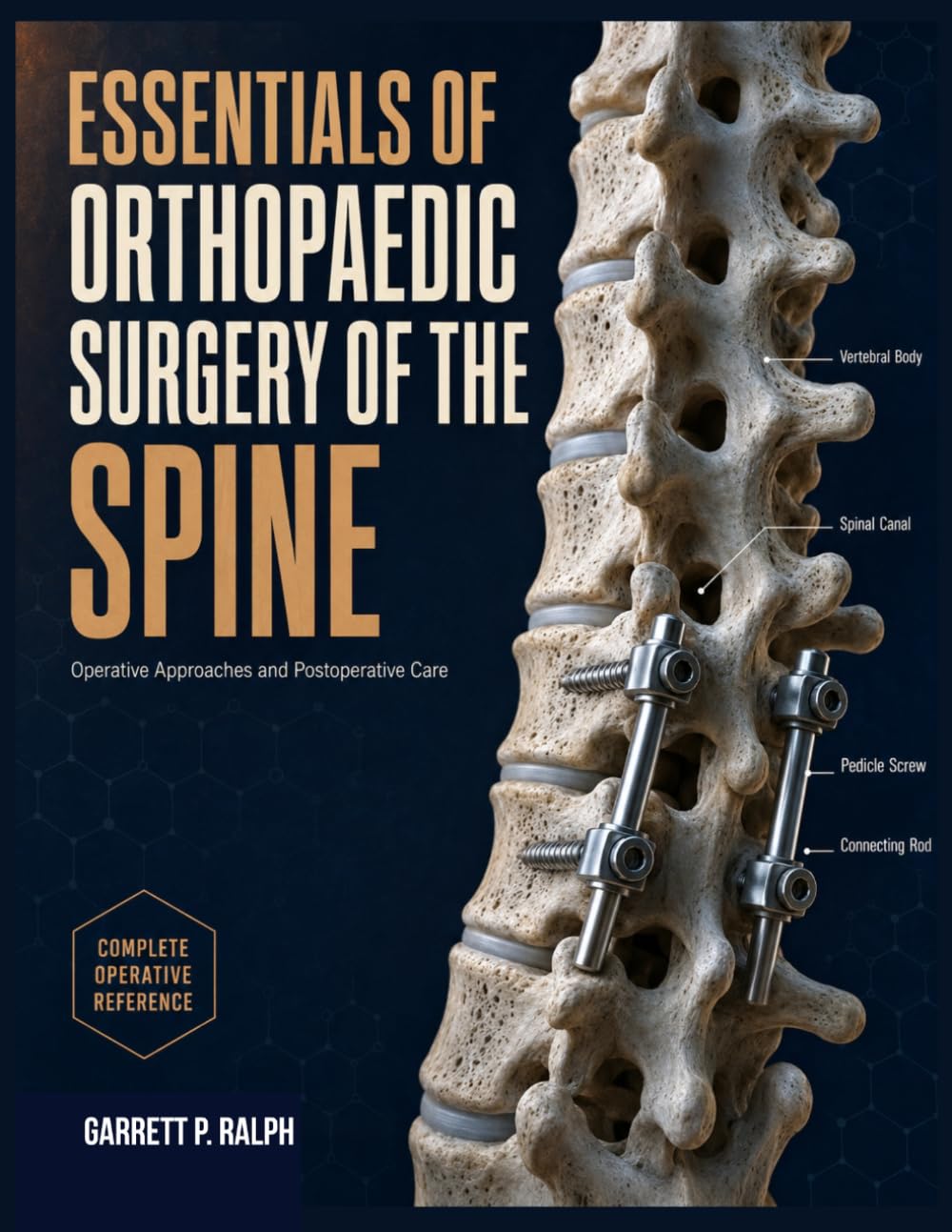 Essentials Of Orthopaedic Surgery of The Spine: Operative Approaches and Postoperative Care