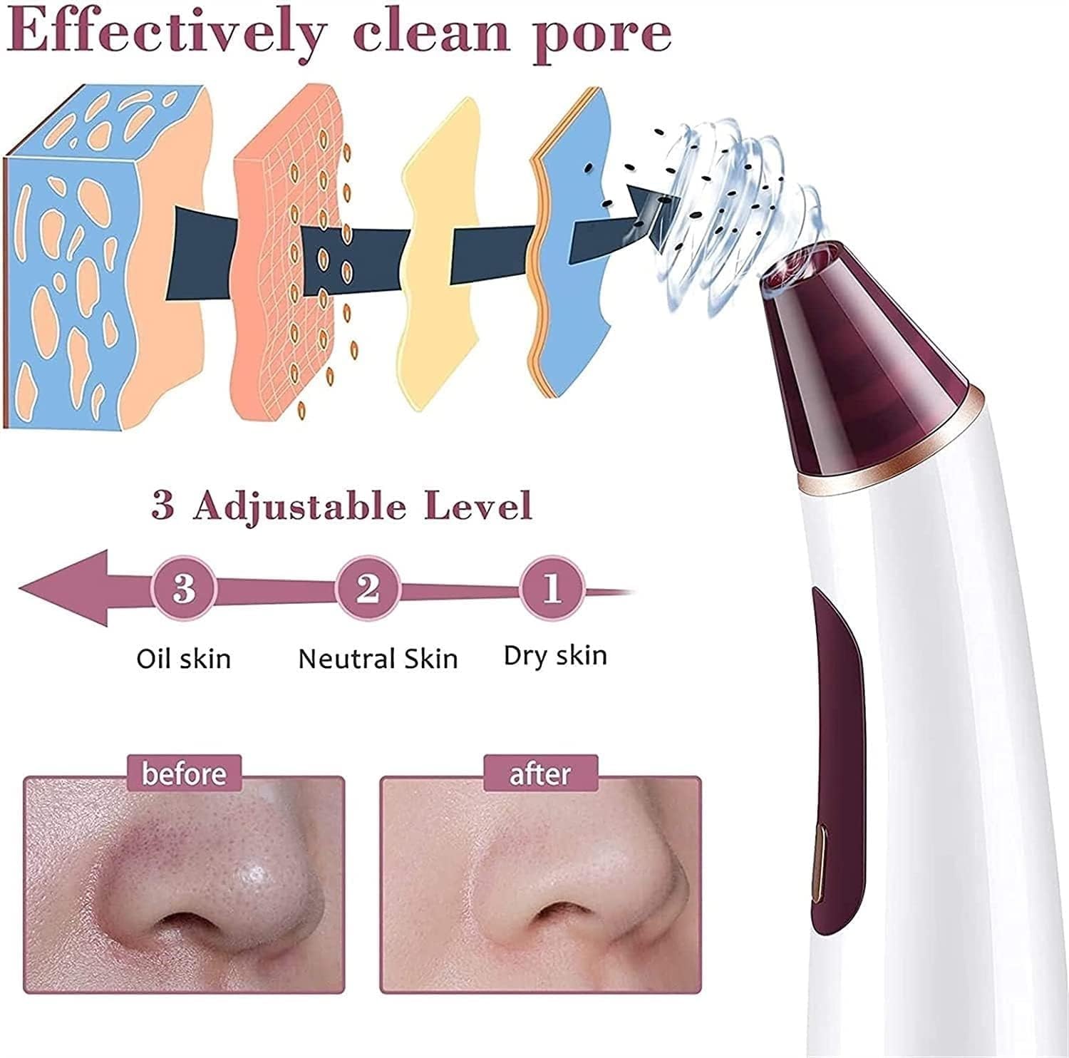 Blackhead Machine Vacuum Pore Cleaner, with Camera Visible Blackhead Removal Facial Pore Cleaner, with 4 Suction Heads