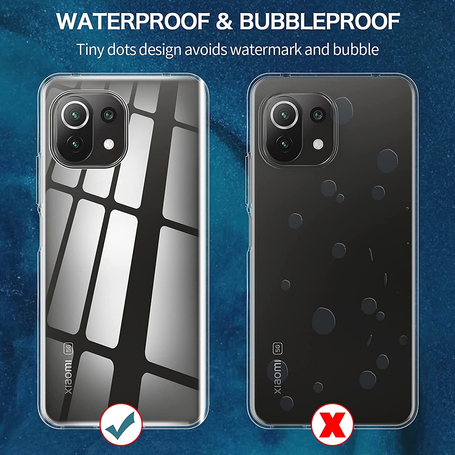 Vauki Cover Con Cordino Per Xiaoi 11 Lite 5G, Cover Con Laccio Glitter - Foto 7