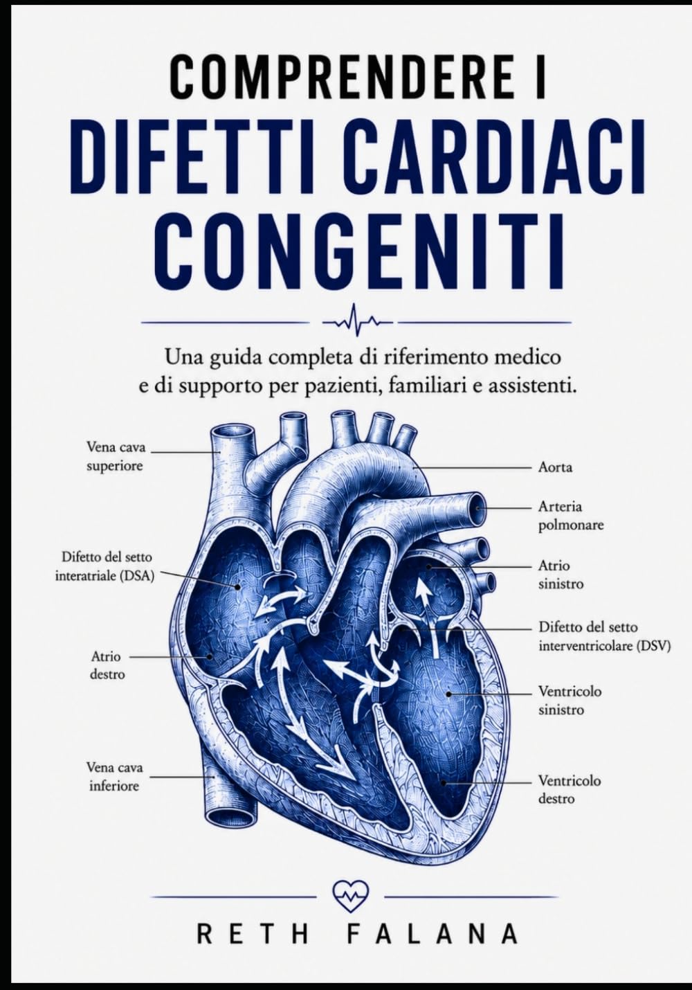 Comprendere i difetti cardiaci congeniti: Una guida completa di riferimento medico e di supporto per pazienti, familiari e assistenti. (La collana ... le patologie cardiache spiegate)