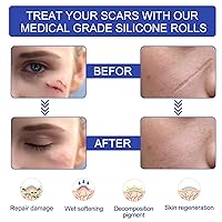 Vista 2 de Hojas de silicona para cicatrices (1.6 x 120 pulgadas, 9.8 ft), cinta transparente para cicatrices, tiras de cicatrices de silicona, cicatrices