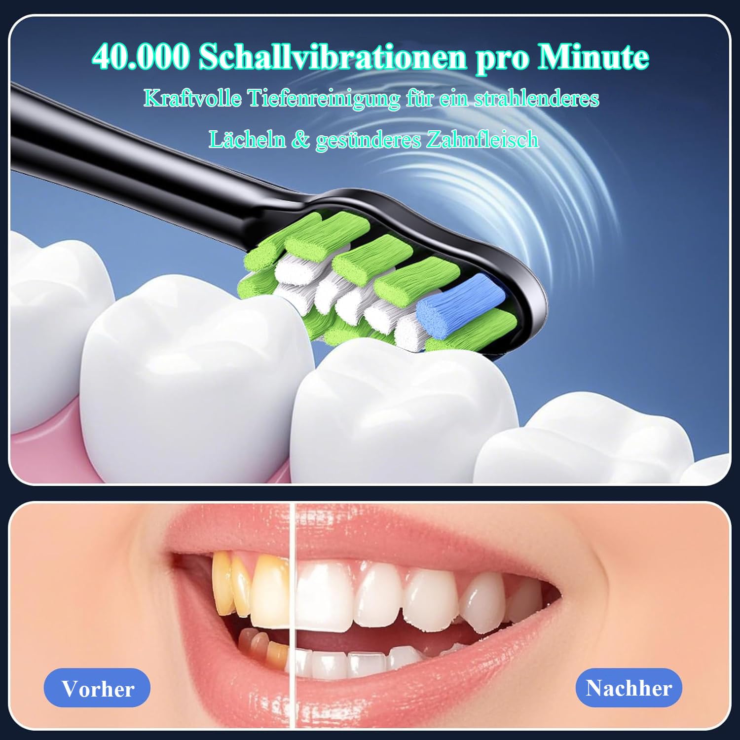 ProSonic V1 – Professionelle elektrische zahnbürste ultraschall mit Schalltechnologie für glattere Zähne und optimale Mundhygiene ultraschallzahnbürste Zahnreinigung zahnaufhellungsgerät (Weiß)