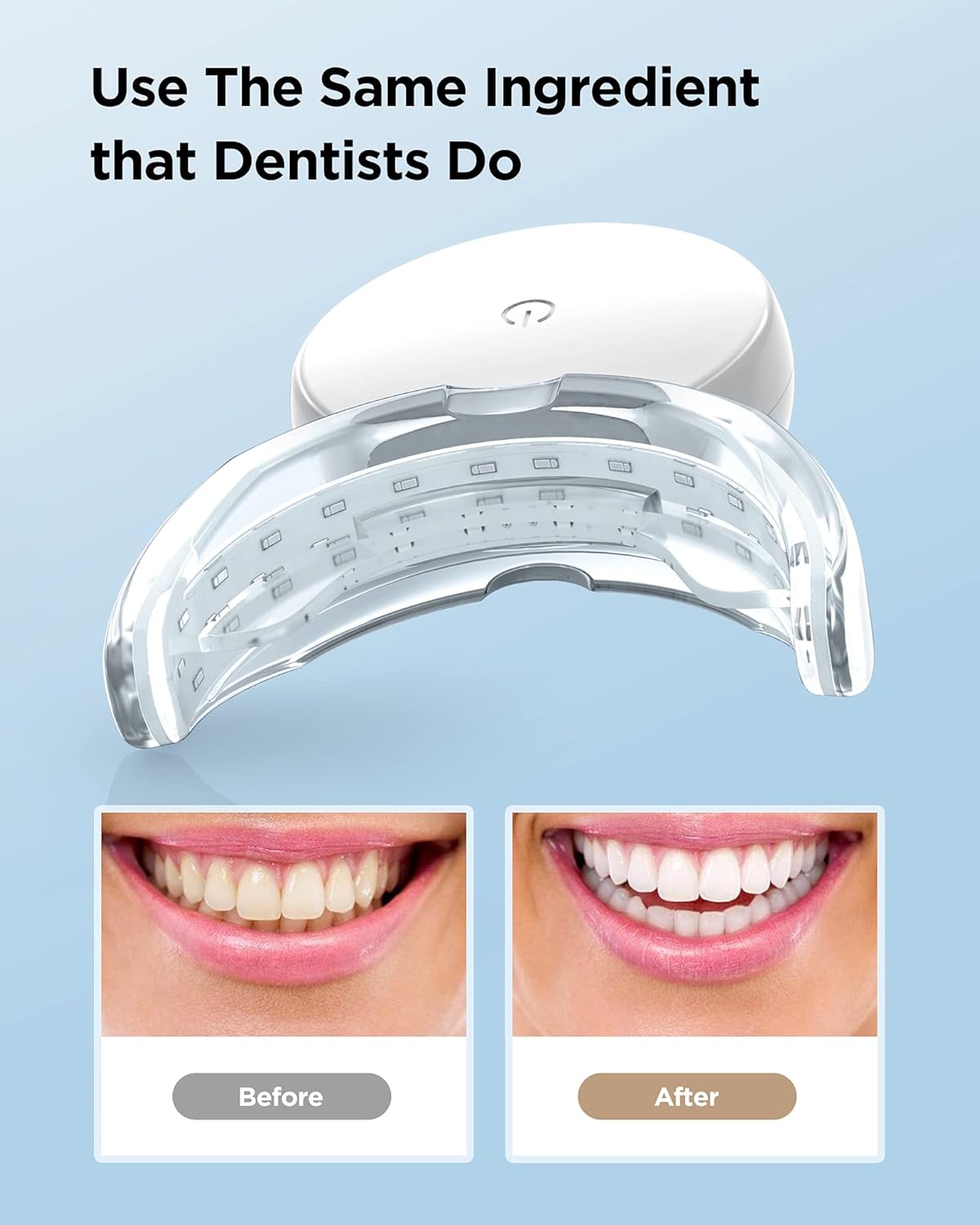 Teeth Whitening Strips with Light , 28 Dentist-Level White Strips for Teeth Whitening , Rechargeable 24X Blue Teeth Whitening Light , Enamel Safe Teeth Whitening Kit with Led Light : Beauty & Personal Care