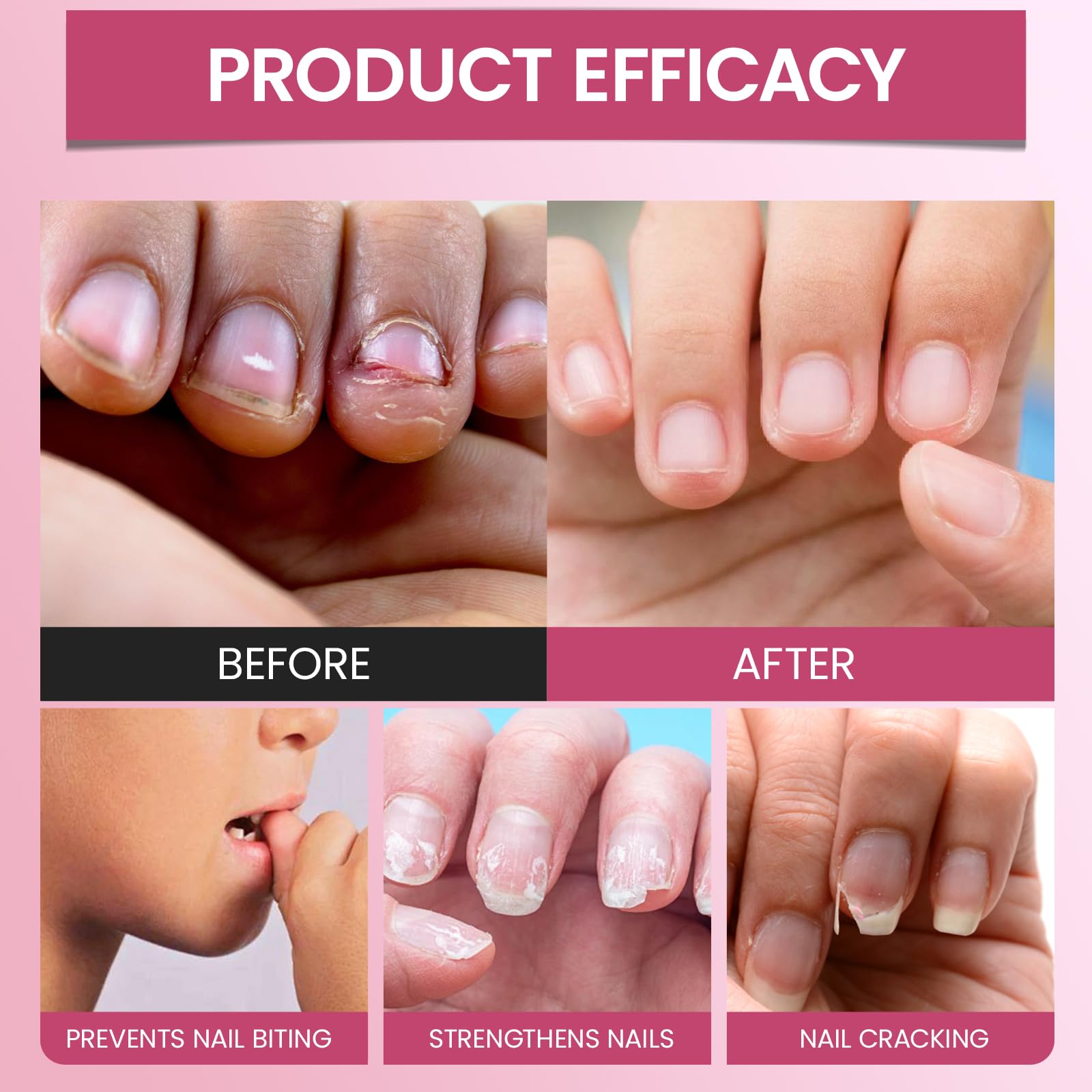 2 Stylos Vernis Amer Anti Ronge Ongles, Stylo Anti-Rongement d'Ongles, Amers pour Enfants et Adultes, Aide à Prévenir le Rongement des Ongles et Succion de Pouce, Facile à Appliquer, Effet Durable