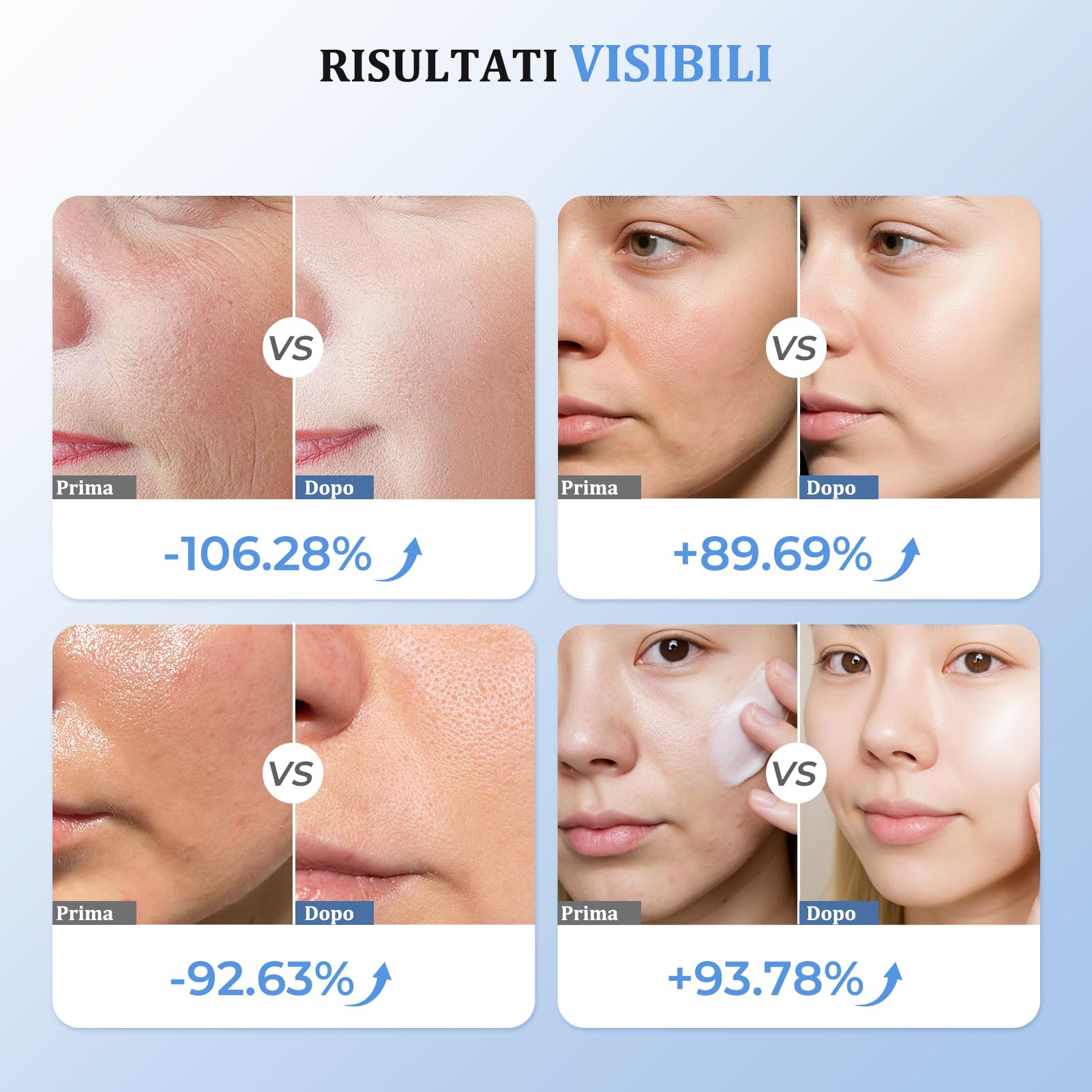 Radiofrequenza Viso Professionale, Microcorrente Massaggiatore Viso, Dispositivo Elettrico di Bellezza Antirughe, Antietà, Anti-Acne, Lifting e Rassodante per Viso e Collo