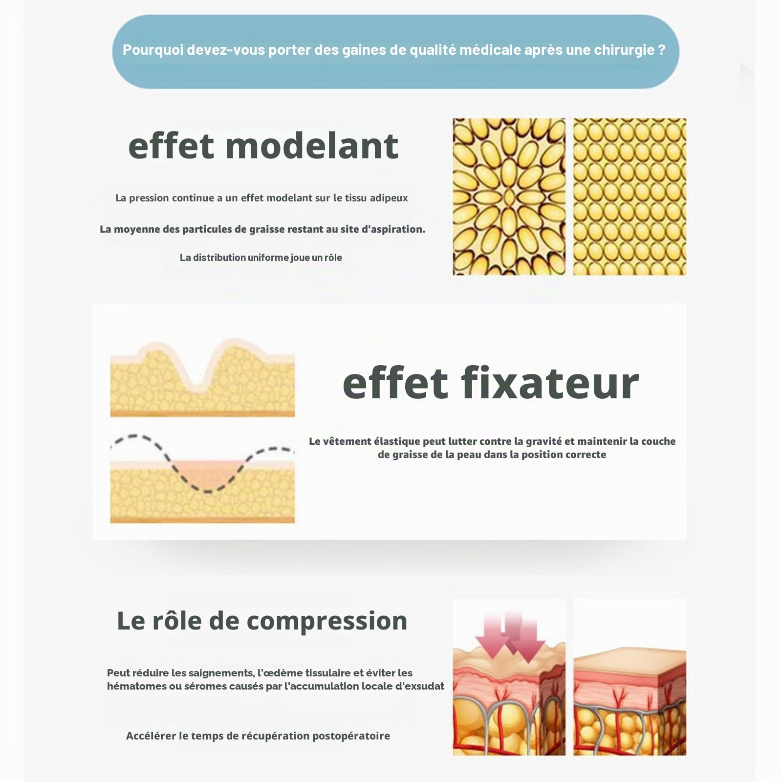 Gaine de Compression Post-opératoire Leggings Amincissants pour les Cuisses et les Fesses Sous-vêtements Sculptants Après une Liposuccion