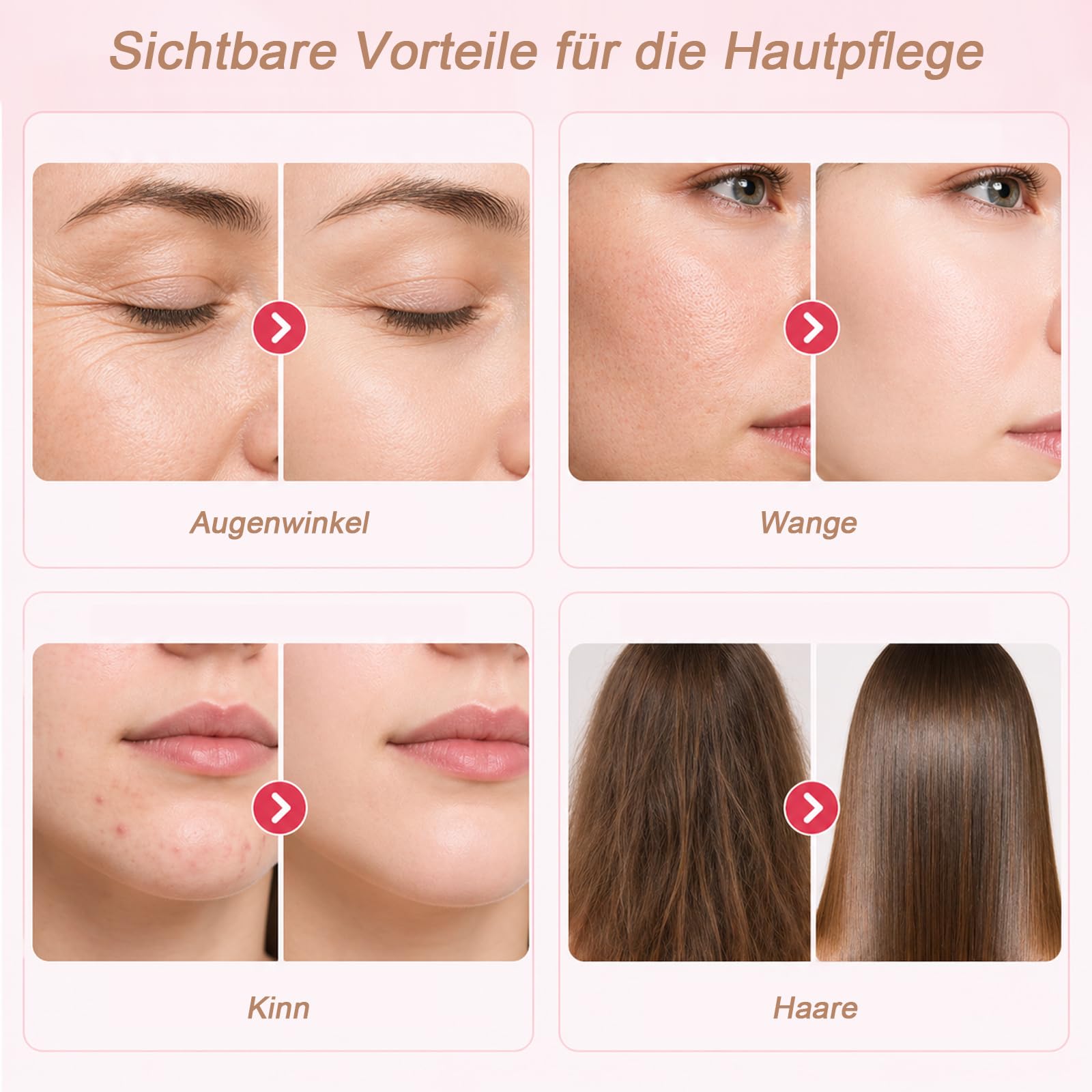 Yofuly Hochfrequenzstab-Hochfrequenz Gerät Akne mit 4 Rote Stab-Schläuchen für Haarwuchs/Aknebehandlung/Faltenreduzierung/Hautstraffung